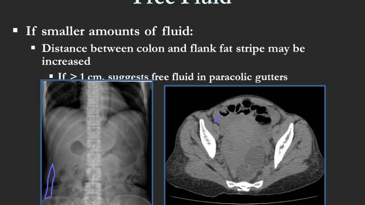 Approach to Abdominal Films 582