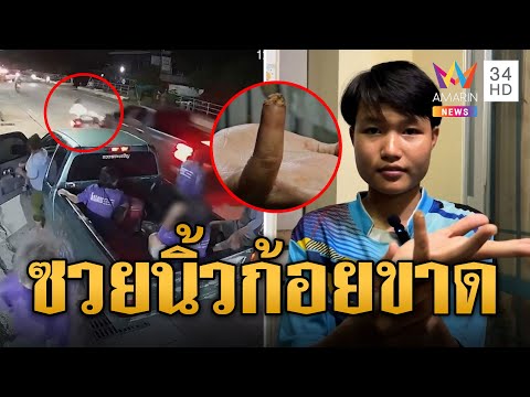 หนุ่มซวย! คนงานโดดลงจากรถไม่ดู เกี่ยวจยย.ล้มนิ้วก้อยขาด