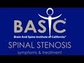 BasicSpine.com - Dr. Ty Spinal Stenosis Symptoms and Treatment Explained