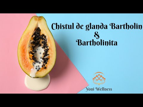 Video: Chistul Bartholin miroase?