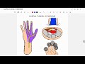 CARPAL TUNNEL SYNDROME