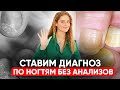 Китайский СПОСОБ узнать болезни по ногтям за 8 МИНУТ