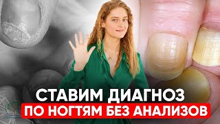видео: Китайский СПОСОБ узнать болезни по ногтям за 8 МИНУТ картинка: Китайский СПОСОБ узнать болезни по ногтям за 8 МИНУТ