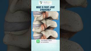 Facet Joint Syndrome Kya Hai? Back Pain Ki Hidden Wajah! #slippeddisc