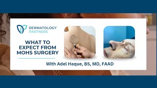 What Is Mohs Surgery? What To Expect With Adel Haque, Bs, Md, Faad