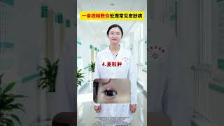 Master Common Skin Diseases with This Easy Video Guide