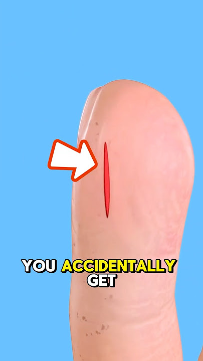 Never Do THIS After a Paper Cut!