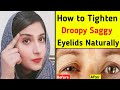 How to tighten droopy saggy eyelids naturally | Top 10 exercises to tighten droopy eyelids