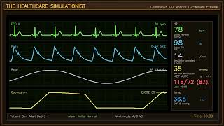 ICU Patient Monitor Simulation | 30 Minutes of Normal Vital Signs & Hospital Sounds ICU Patient Monitor Simulation | 30 Minutes of Normal Vital Signs & Hospital Sounds