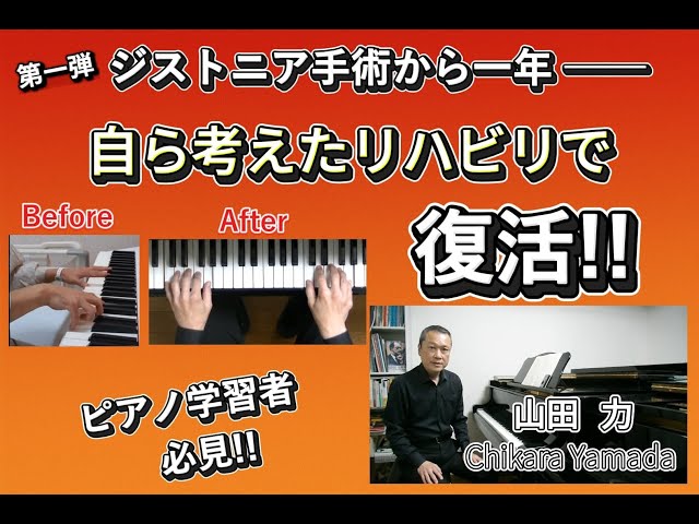 ジストニア 手術後のリハビリ第一弾 ～一般のピアノ学習者にもオススメ
