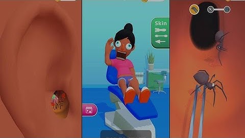 Earwax Clinic New All Levels Game Mobile iOS,Android  Walkthrough Gameplay EWCGP06
