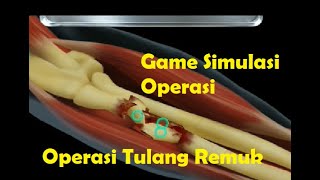 Game Simulasi Operasi Patah Tulang -- Operate Now : Hospital screenshot 3