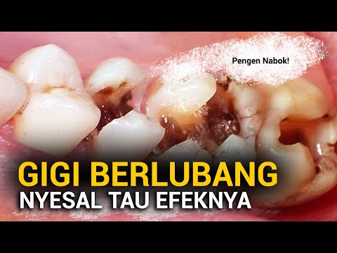 Video: Apa Yang Alkohol Lakukan Pada Gigi Anda?