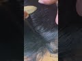 #fypviralシ #statisfying #lice #hair #LiceOnHead #liceremoval  #brasil #xyzbcafyp #licecomb  #kutu