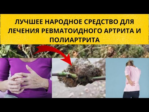 Эффективное средство для лечения ревматоидного артрита и полиартрита - Галлы шиповника