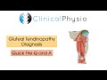 Classic Gluteal Tendinopathy Diagnosis | Clinical Physio