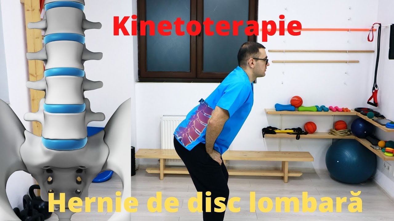 Exerciții pentru hernia de disc lombară. Durere de spate. Ședința 5