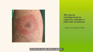 Key Points on Diagnosis, Testing and Treatment