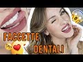 DENTI FINTI ?!?! FACCETTE DENTALI E RISULTATO NATURALE!