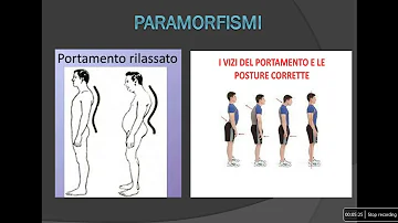 Che cosa sono i dismorfismi?
