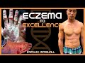 Defying Doctors: From Eczema to Excellence with Bradley Marshall&#39;s Lion Diet Odyssey