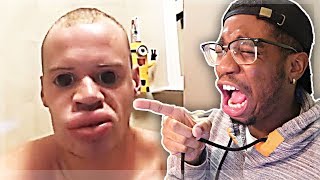 THIS DUDE INJECTED LIP FILLERS IN HIS LIPS!!! | Worst Fails of 2019