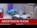 Texas Medical Board hears abortion ban testimony