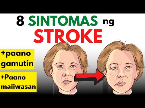 8 Sintomas ng STROKE | Mga sanhi, gamot, lunas, paano aalagaan at paano maiiwasan | Mild Stroke