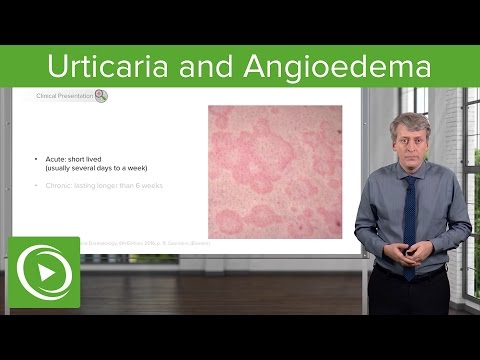 Video: Chronische Idiopathische Urticaria: Afbeeldingen, Symptomen En Behandeling