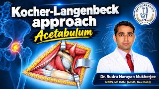 The Kocher-Langenbeck Approach to the acetabulum : A Practical Guide for Surgeons