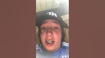 Which lefty pickoff move is better #baseball #pickoffs #italy #pitching #lefty