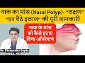 Nasal Polyps, नाक के बढे हुए मांस का इलाज कैसे करे , Naak me Maas ka Badhna, Nasal Polyps Treatment