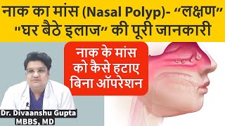 Nasal Polyps, नाक के बढे हुए मांस का इलाज कैसे करे , Naak me Maas ka Badhna, Nasal Polyps Treatment