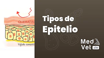 ¿Qué características tiene el epitelio de transición y para qué sirve?