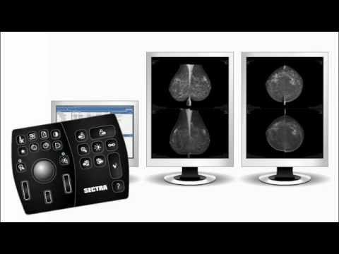 Sectra Breast Imaging RIS/PACS - YouTube