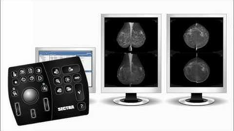 Sectra Breast Imaging RIS/PACS