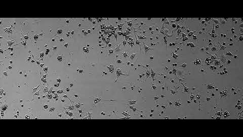 PC12 rat adrenal medulla cells