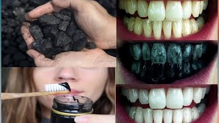 Le moyen le plus rapide de blanchir les dents en seulement deux minutes 100 % defficacité