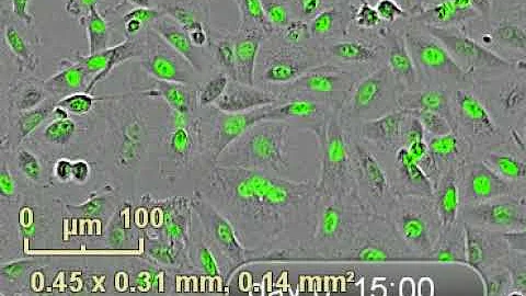 Cancer cells (control 48 h)