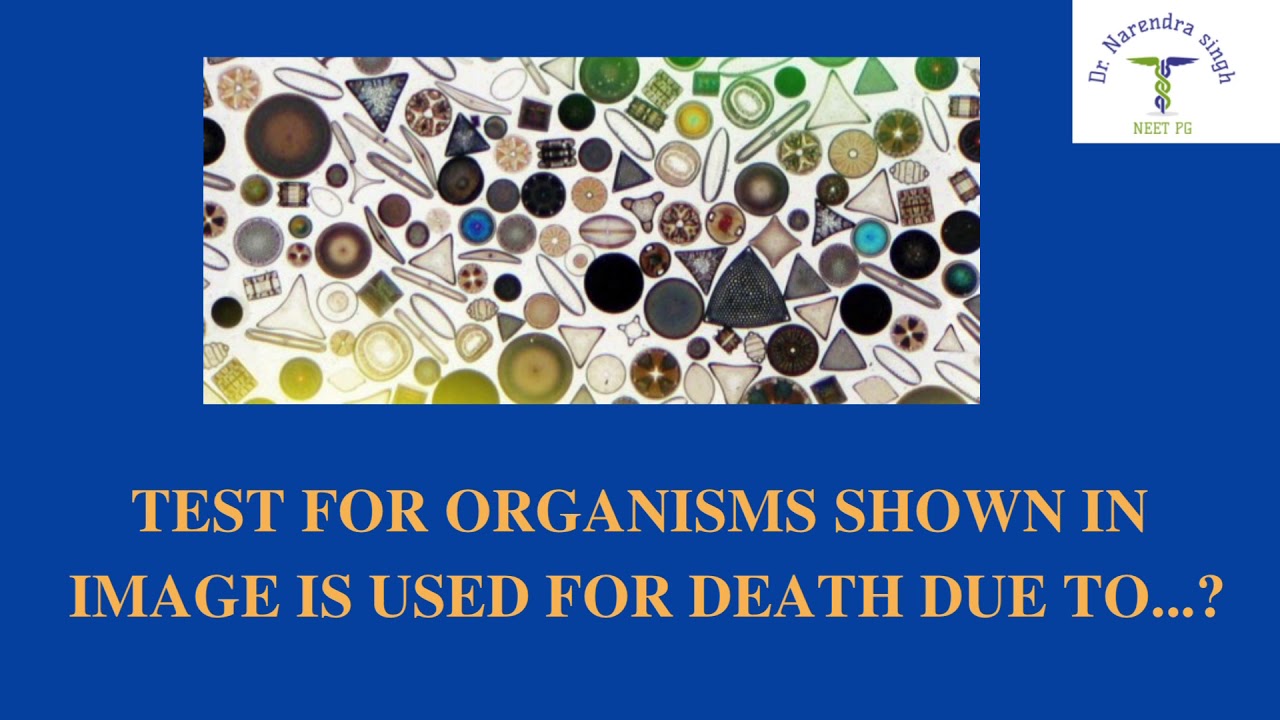 NEET PG QUICK RIVISION IMAGE BASED MCQ:123/ NEETPG2021/ DNBCET/ INICET/ INEXT