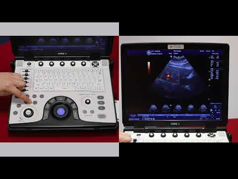 A basic overview of colour options and m mode on the GE logiq e ultrasound scanner - video 5