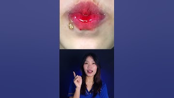Niềng Răng không nên ăn gì? Tìm hiểu cùng Nha Khoa HAPPY nhé.