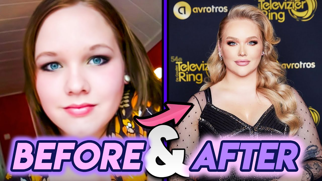 Nikkietutorials Before And After Transformations Her Cosmetic Surgery And More Youtube