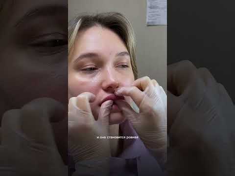 Как правильно делать массаж после увеличения губ?🤔 #увеличениегуб #косметолог #красноярск