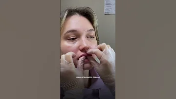 Как правильно делать массаж после увеличения губ?🤔 #увеличениегуб #косметолог #красноярск