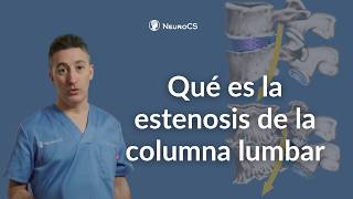 Estenosis de la columna lumbar: qué es, síntomas, causas y tratamiento en España