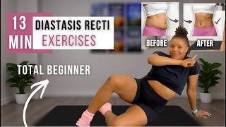 13-Minute Diastasis Recti Exercises to Strengthen Deep Core (with instructions)