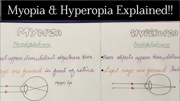 Myopia and Hyperopia|Nearsightedness and farsightedness