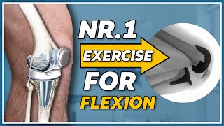 The nr.1 exercise for gaining knee flexion after knee replacement screenshot 5