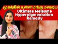 மங்கு மறைய இதை செய்யுங்க / How To Get Rid of HYPER PIGMENTATITON - #Melasma #Freckles #Dark Spots